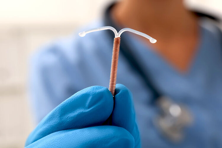 Copper IUD: ข้อดีข้อเสียคืออะไร?